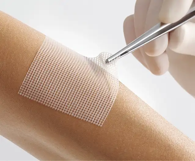 Lomatuell Pro gelbildendes Kontaktnetz Lomatuell Pro gelbildendes Kontaktnetz