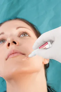 Leukoplast skin adhesive 0,7 ml