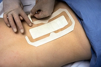 Tegaderm plus Pad steril Tegaderm plus Pad steril